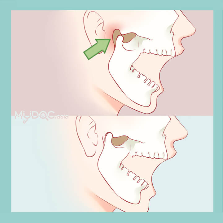 procedures-icon-temporomandibular-joint-treatment.jpg